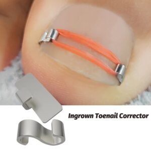 Ingrown Toenail Corrector for Gentle Nail Care