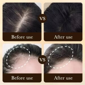 Biotin Hair Growth Oil Scalp Massage Serum