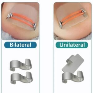 Ingrown Toenail Corrector for Gentle Nail Care