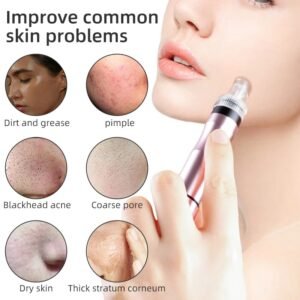 Hydra Dermabrasion Blackhead Removal Device