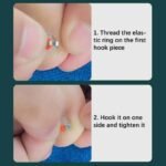 Ingrown Toenail Corrector for Gentle Nail Care